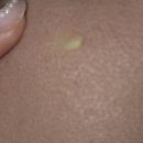 (A+)바른케어 이미지