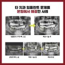 예스플러스치과 이미지