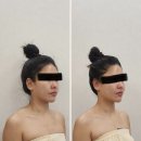 씨유삼산주차타워점 | 울산남구피부관리 / 울산삼산에스테틱 “아뜰리에드스킨”4D카밍리프팅 4회차 후기