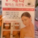 김송헤어라인 | 올려주고 채워주는 V-세라 리프팅으로 피부 탄력 채우기, 대구 피부관리 수성구 전신관리 '테라피미애' :D
