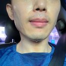 에이스리커버리 이미지