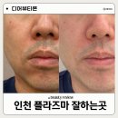 63 | 주안피부샵에서 인천플라즈마 주안동피부관리 받고 온 후기