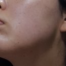 청주하안유산부인과/1인실/입원실/출산가방추천템/내부사진有