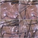 밥 퍼주는 남자 | 영통역두피 관리 "수원탈모관리 두피밥 수원점" 두피 진단 후 풀코스 두피케어 후기