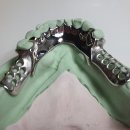 프레임치과기공소 이미지