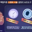 심부전 (숨차는) 원인 검사 이미지