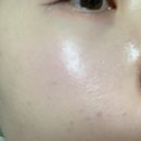 셀로라바이 펜타샷 모공 디바이스 내돈내산 후기 공유