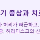 스윙스윙 점프 줄넘기(초1~6) | 허리디스크 초기 증상과 치료법 총정리 : 통증에서 해방되는 방법