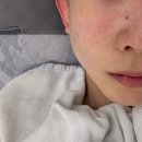 명륜] 피부관리 모공관리 모공줄이는 법 동래 에스테틱 추천 올가드림뷰티 온천장점 모공디톡스 솔직 후기