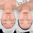 The예뻐지다 | 전북 전주시 에코시티 더예뻐지다에서 웨딩관리 받은 비포애프터