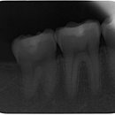 디지레이 이미지
