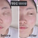 이엠(EM)메디칼 이미지