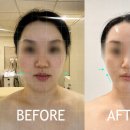 6082 | 마포에스테틱 리지그 더마튠 탄력관리, 바디와 페이스를 동시에 잡는 듀얼 케어 후기