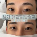 강남 애교살반영구 남자애교살 반영구 최다시술