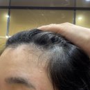 효경헤어 | [광주/방림동] 1:1맞춤 토탈 왁싱샵 더스무스왁싱피부 광주봉선점에서 헤어라인 왁싱하고 온 후기