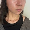 창원 남양동 피부관리샵 '아리움' 모공 디톡스 후기