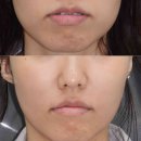 경우 | 덴서티 후기 알아보는 경우