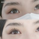 아델론네일
