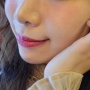 샤인성형외과 | 수면쥬베룩 스킨 부스터 시술 후기, 신사 성형외과 피부과 쥬베룩 더마샤인 1cc 가격 신사역 쥬베룩...