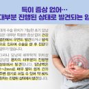 담낭암 담낭암 원인 증상 치료 담낭암 발견이 늦은 이유 쓸개암 담낭암 생존율 이미지