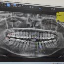 턱편한사랑니치과의원 이미지
