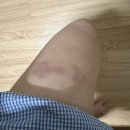 이마트24 광주열린병원점 | 외향인의 가짜 칩거(3월) 일기