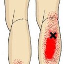 강남보성한의원 이미지