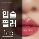 울산 입술필러가 빨리 빠져 입술 필러 리터치를 고민하고 있다면