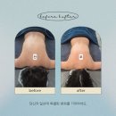 라비에벨 | 부천 신중동 슬리밍 마사지 라비에벨뷰티 후기 :등살 관리 끝판왕