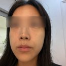 퍼스트메디 | 노원역 피부관리 퍼스트메디스킨 재방문! 칙칙한 안색 환하게 밝혀준 맞춤 미백 톤업 케어