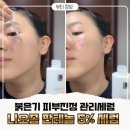 대한크린개발 | 건조하고 예민한 피부 열감 내리는 진정세럼 추천, 레이어랩 니오좀 판테놀 세럼 솔직 사용후기