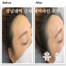 강남대역 | : 유월 : 용인 헤어라인 정리 강남대역 근처 솔직후기