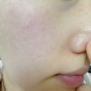 스펀지 | 블랙헤드 없애는법 고민 끝! 얼굴 각질제거까지 가능한 세안 스펀지 후기 ✨