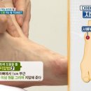 건강 셀프 발 마사지 이미지
