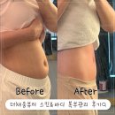 더힐링스킨&바디 | 뱃살부자의 초지동 바디관리 더채움뷰티 스킨&바디 복부관리 안산 웨딩케어 내돈내산 후기