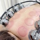 CU서산석림한성점 | 서산 아온담뷰티 승모근·거북목·버섯목 순환관리 솔직후기