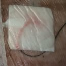 대명밧데리 | 엠산부인과 :: 제왕절개 준비물 및 6박7일 입원후기