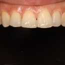 용치과기공소 이미지