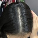 한들약국 | 지성샴푸 추천 두피관리법 후기 정착하기까기 고생했다..