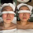 오운스킨라운지 | [뷰티] 강남 논현동 오운스킨라운지 20년 웨딩경력 원장님의 퍼스널 예신관리(피부/윤곽)