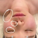 메디핏 | 제이메디스킨, 송도 피부관리 LPG 페이스핏 솔직후기