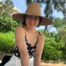 글로벌365mc병원 | 팔뚝살과의 전쟁ㅣ대전 365mc 병원에서 지방흡입 상담 리얼후기ㅣfeat.지방 줄기세포 스킨부스터