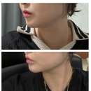 신에너지 | 부산 올타이트리프팅 전후 비교, 처진 볼살에 착붙 라인 찾은 후기!