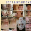 사라피부