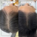 일리즈눈썹&속눈썹펌 이미지