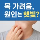 햇빛약국 | [공지] 햇빛알러지 피부과진단 처방 후기 처방 후기 목 가려움