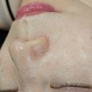 토닥토닥 | 동두천 '라벨르 스파' 세라링 피부 관리