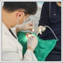 희망치과기공소 | 하남임플란트 식립 전 고려할 내용