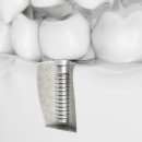 나란이치과의원 이미지