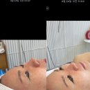 매탄2동 199-42~매탄2동 199-50 | 군산피부관리 퀸다경뷰티 듀얼테트라 모공디톡스 윤곽관리 물광관리